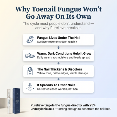 Purelieve® Antifungal Nail Pen — 25% Undecylenic Acid + Tea Tree
