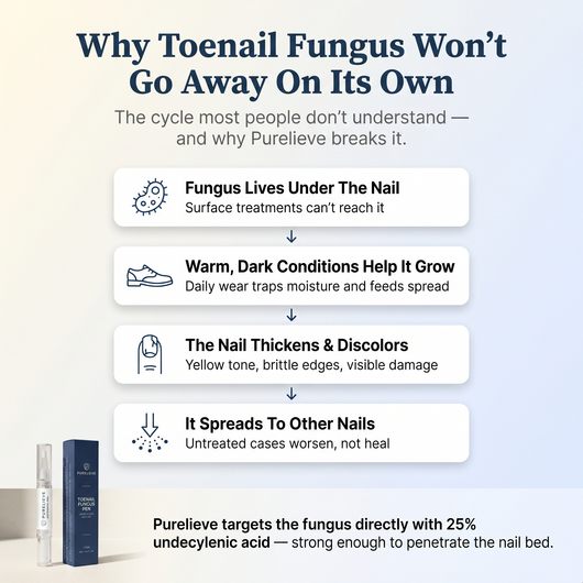 Purelieve® Antifungal Nail Pen — 25% Undecylenic Acid + Tea Tree