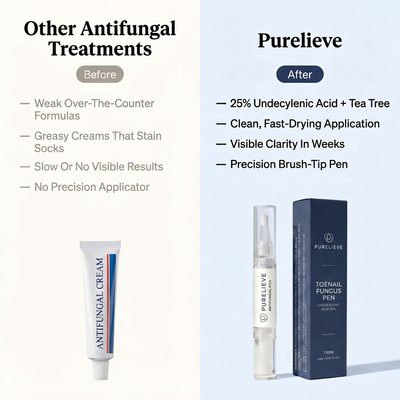 Purelieve® Antifungal Nail Pen — 25% Undecylenic Acid + Tea Tree