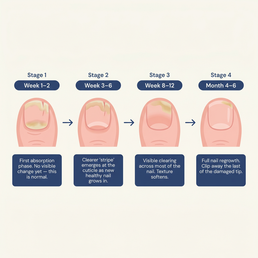 7. The 90-day money-back guarantee is built to match how nails actually grow